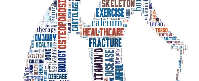 Homecare in Dadeville AL: Dealing with Osteoporosis