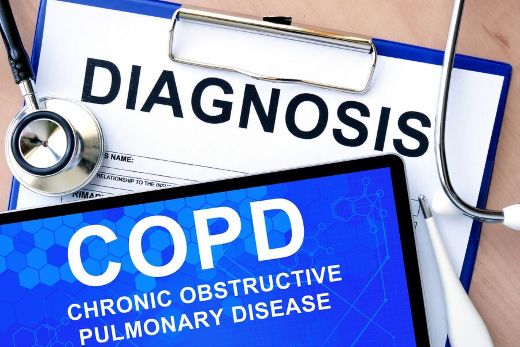 Homecare in Opelika AL: Know and Avoid COPD Triggers